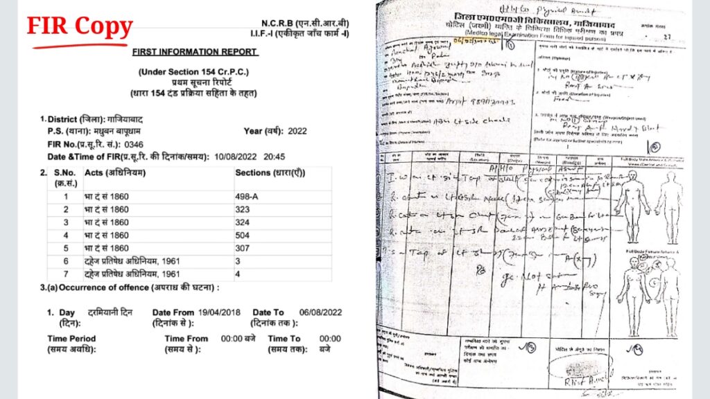 ‘Disability Certificate’ Scam Allegations: Same UPPSC–UPSC Candidate Shows 0% to 67.84% Disability; Multiple Agencies Launch Probe